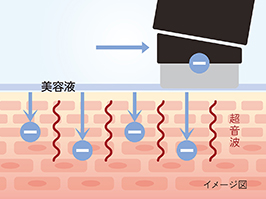 イメージ:モイストモード【超音波＋保湿ケア(イオン導入)】