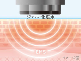 イメージ:RF+EMSモード(約5分)