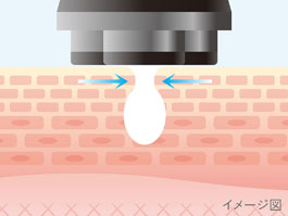 イメージ:COOLモード(約3分)